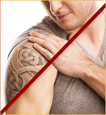 tattoo removal clinton twp