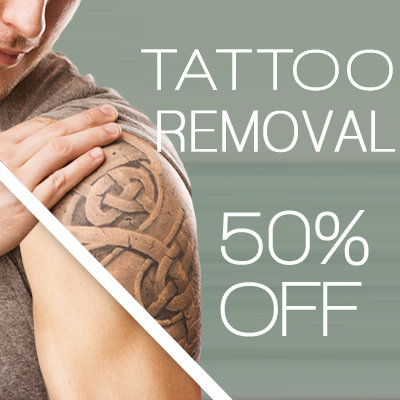 tattoo removal deal